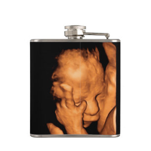 Grandpa Gravid Ultrasound Sonogram Baby Photo Fickplunta