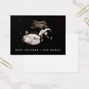 Gravid annons Sonogram Mini Card-paket Visitkort