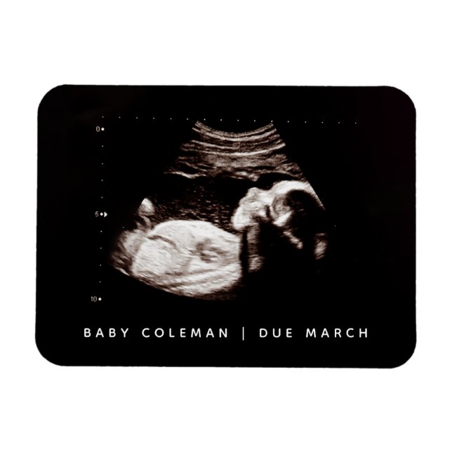 Gravid Announcement Baby Sonogram Photo Magnet (Horisontell)
