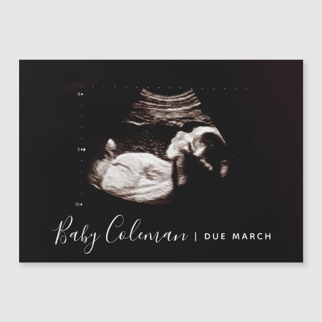 Gravid Announcement Sonogram Namn Magnet (Framsida)