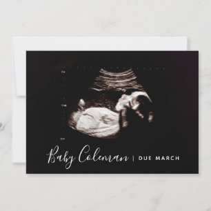 Gravid Announement Sonogram Namn-skriptkort Meddelande