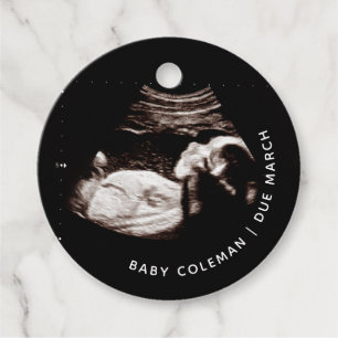 Gravid Anteckning Baby Sonogram Photo Circle Gåvor Etiketter
