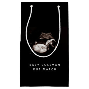 Gravid Baby Sonogram Ultraljudsfoto