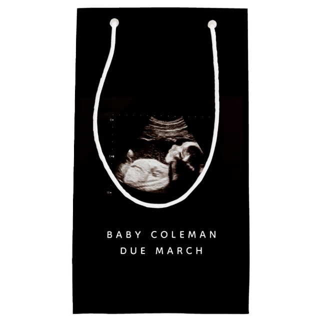 Gravid Baby Sonogram Ultraljudsfoto (Framsidan)