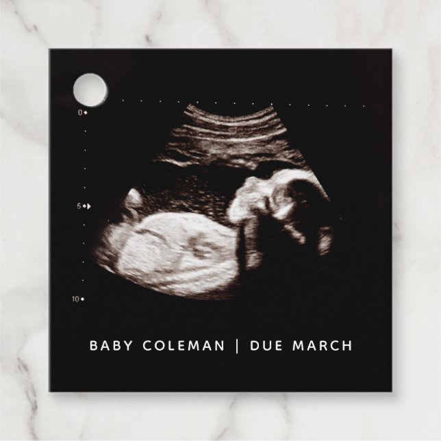 Gravid Baby Sonogram Ultraljudsfoto Gåvor Etiketter (Framsida)