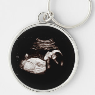 Gravid Baby Sonogram Ultraljudsfoto Ny mamma Rund Silverfärgad Nyckelring