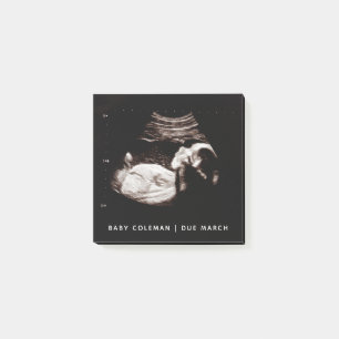 Gravid Baby Sonogram Ultraljudsfoto Post-it Block