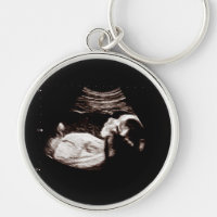 Gravid Baby Sonogram Ultrasound Photo New mamma