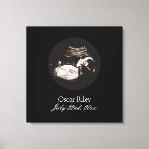 Gravid Baby Sonogram Ultrasound Photo Nursery Canvastryck