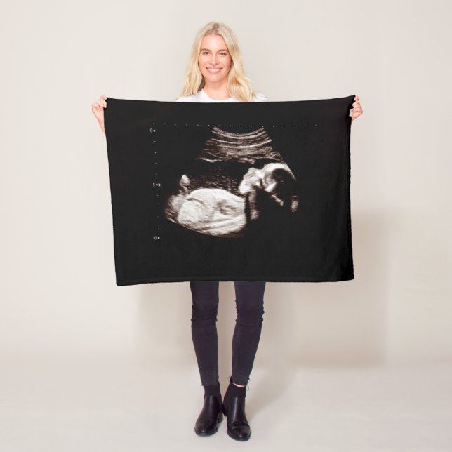 Gravid Keepsaké Baby Ultrasound Sonogram Foto Fleecefilt (På plats)