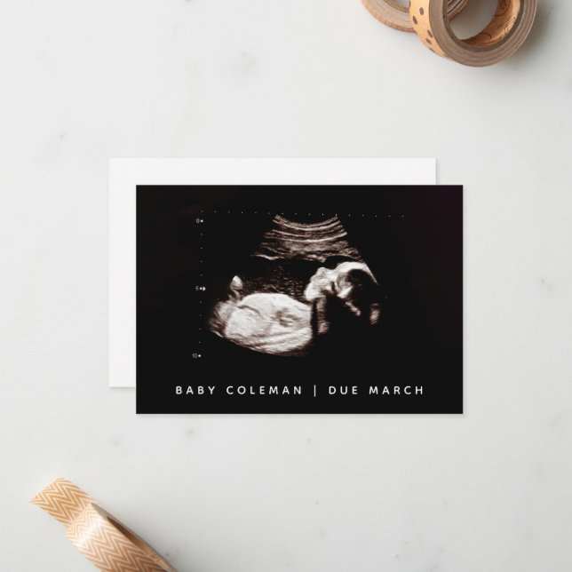 Gravid Reveal Baby Ultrasound Sonogram Photo Anteckningskort (Fram/Back In Situ)