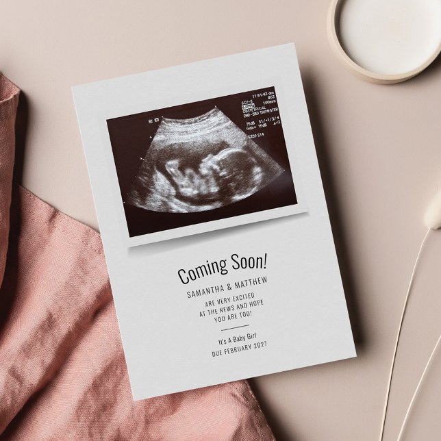 Gravid Sonogram kommer snart Baby (Skapare uppladdad)