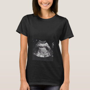 GRAVID TURKIET ULTRASOUND T SHIRT