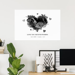 Gravid Ultraljudsmeddelande kommer snart Poster