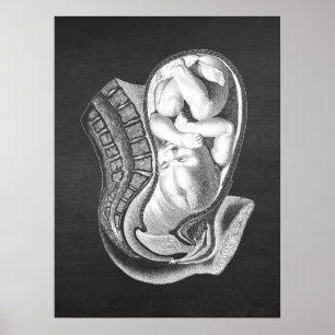 Gravid Womb Anatomy Obstetric Decor no.1 Poster