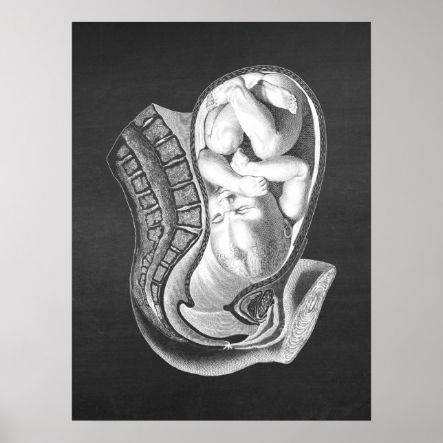 Gravid Womb Anatomy Obstetric Decor no.1 Poster (Framsidan)
