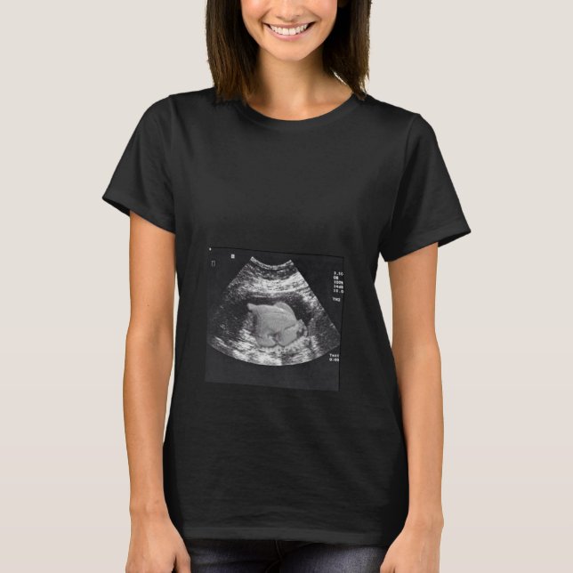GRAVIDA TURKIET ULTRASOUND T SHIRT (Framsida)