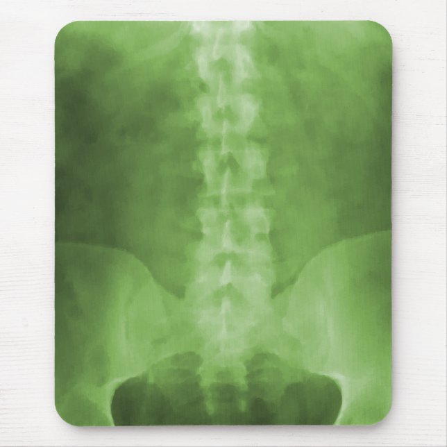Gröna Digital röntgar konst Mousepad Musmatta (Framsidan)