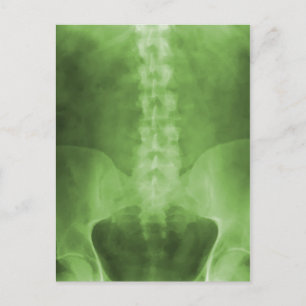 Grönt Digital X-Ray Art-vykort Vykort