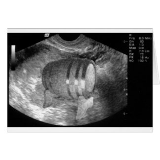 Guy's Card Hälsningskort