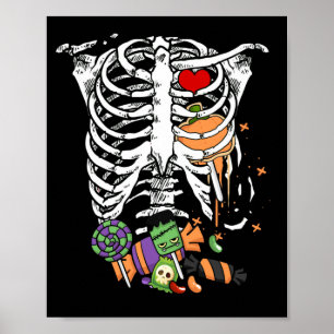 Halloween Candy Skeleton Rib Cage X-Ray Poster
