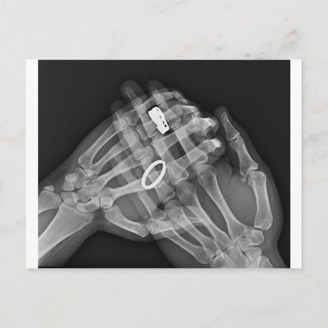 Hand Holding Vykort (Framsida)