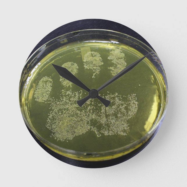 Hand Petri Dish Bacteria Rund Klocka (Framsida)