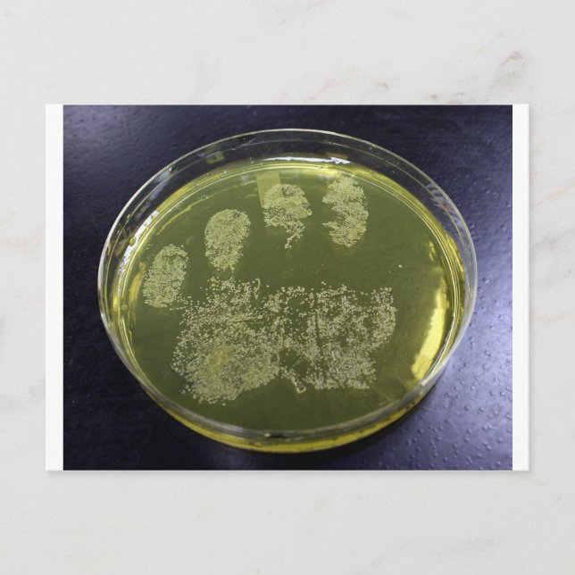 Hand Petri Dish Bacteria Vykort (Framsida)