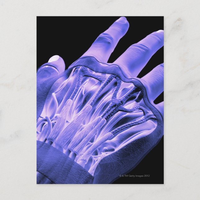 Handmuskler Vykort (Framsida)