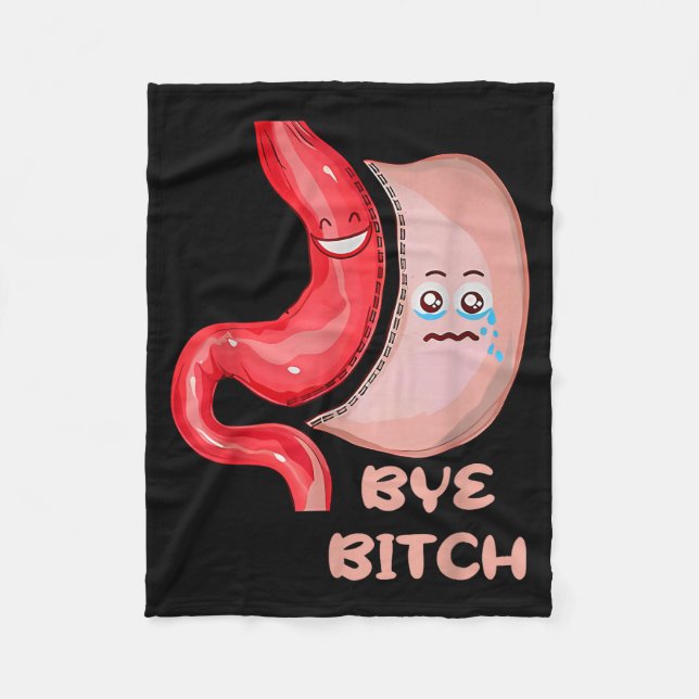 Hejdå Rolig Gastrisk Sleeve Kirurgi Mage  Fleecefilt (Framsidan)