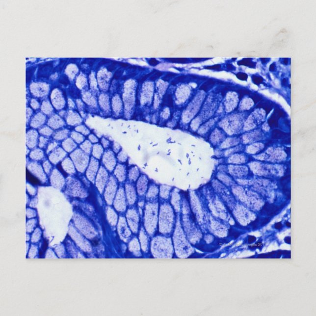 Helicobacter Pylori Vykort (Framsida)