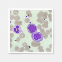 Hematologi för mikroskop från rbcs-skivor