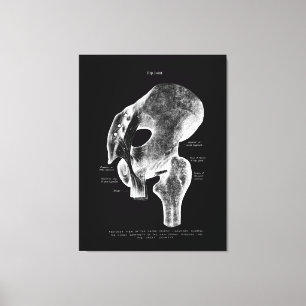 Hip Joint Anatomy Median Large Canvas Art