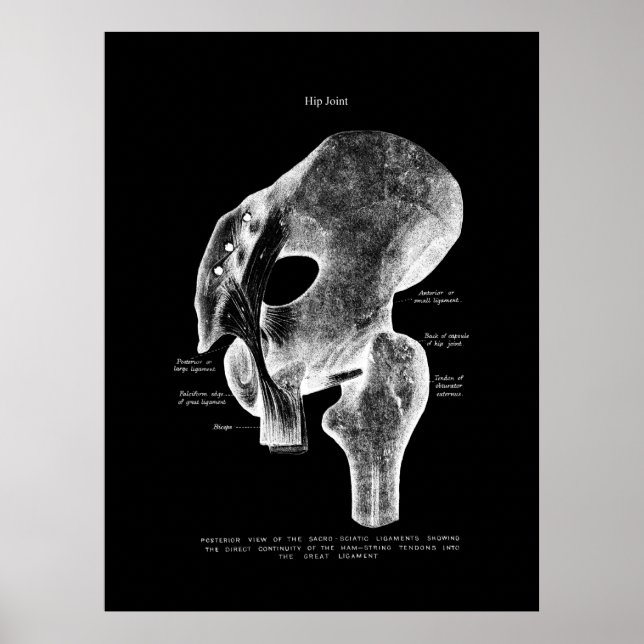 Hip Joint Anatomy Medical Poster (Framsidan)