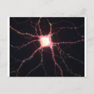 Hippocampal neuron 2 vykort