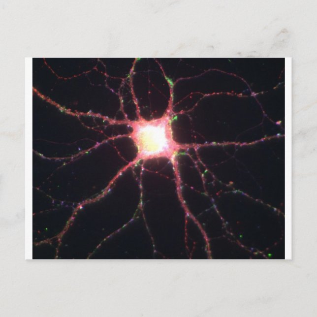 Hippocampal neuron 2 vykort (Framsida)