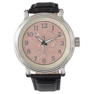 Histologi Graft Wrist Watch Armbandsur