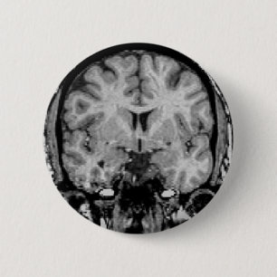 Hjärna MRI, coronalskiva Knapp
