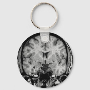 Hjärna MRI, coronalskiva Nyckelring