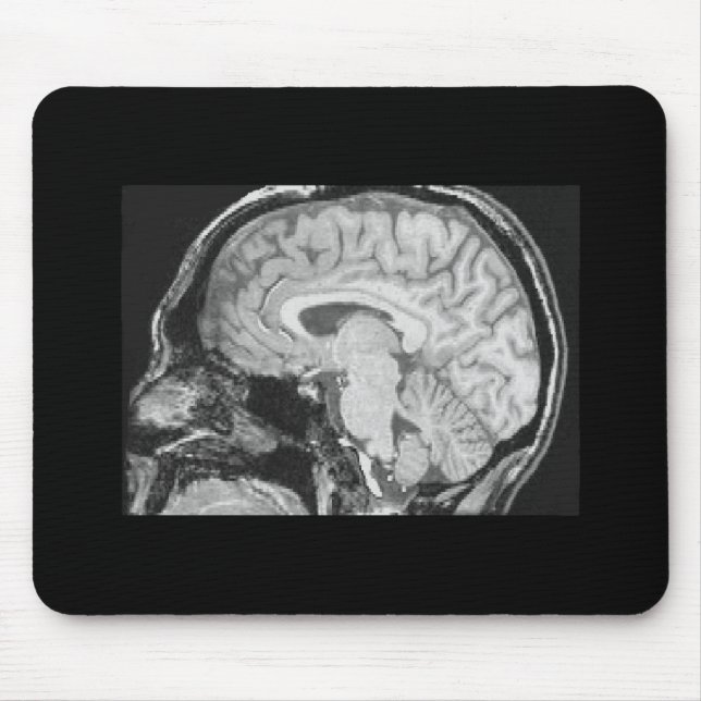 Hjärna MRI Musmatta (Framsidan)