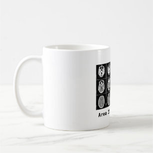 Hjärna: Område 25 gjorde mig att göra honom Kaffemugg