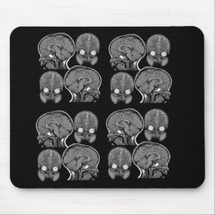 HJÄRNOR! (MRI) MUSMATTA