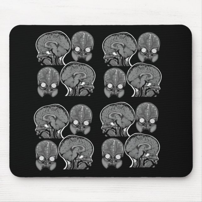 HJÄRNOR! (MRI) MUSMATTA (Framsidan)