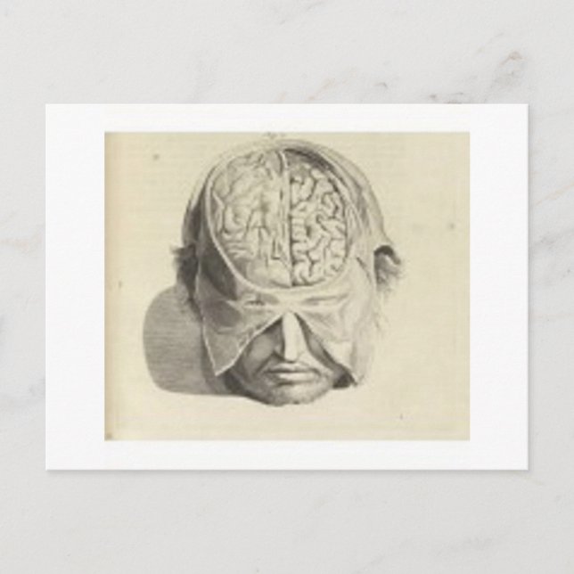 Hjärnor Vykort (Framsida)