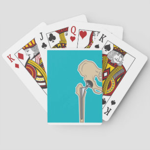 Höftledutbyte Casinokort