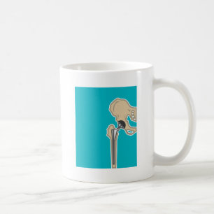 Höftledutbyte Kaffemugg