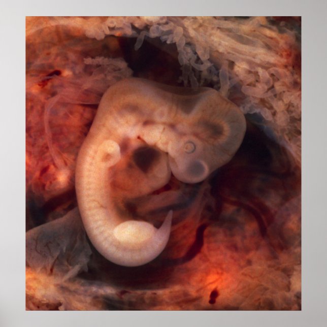 Human Embryo 7:e Vecka Gravid 5th Peek P. O. Poster (Framsidan)