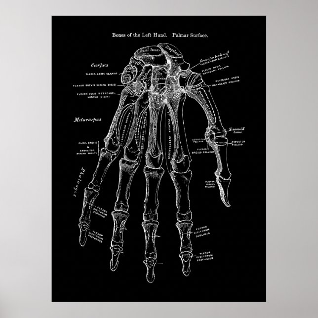 Human Hand Bone Anatomy Art Poster (Framsidan)