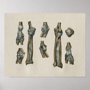 Human Joint Anatomy Vintage Print Poster