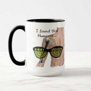 Humous Humerus Funny Medical Personlig Mugg